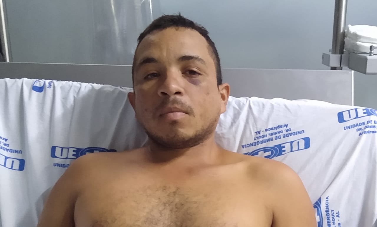 Vitima de atropelamento está sem documentos e hospital de Arapiraca pede ajuda